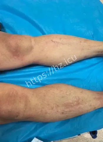 台风后蚂蚁性情大变